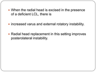  When the radial head is excised in the presence
of a deficient LCL, there is
 increased varus and external rotatory instability.
 Radial head replacement in this setting improves
posterolateral instability.
 