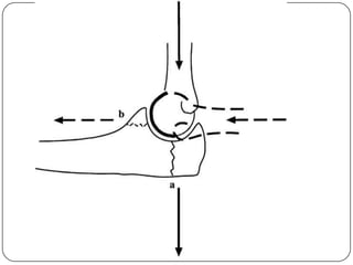 Anatomy and Biomechanics of the Elbow Joint