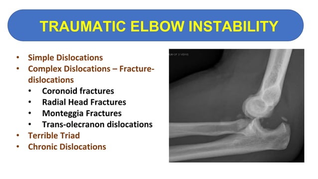 Knee high christmas socks