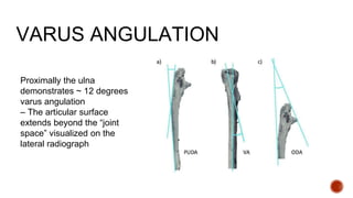 Ulna Varus ELBOW INJURY AND TERRIBLE TRAID.pptx