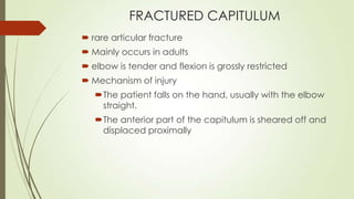 FRACTURED CAPITULUM
 rare articular fracture
 Mainly occurs in adults
 elbow is tender and flexion is grossly restricted
 Mechanism of injury
The patient falls on the hand, usually with the elbow
straight.
The anterior part of the capitulum is sheared off and
displaced proximally
 