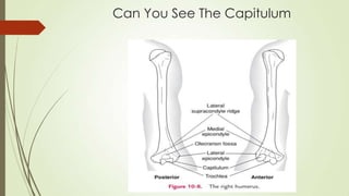 Can You See The Capitulum
 
