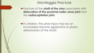Monteggia Fracture
Fracture of the shaft of the ulna associated with
dislocation of the proximal radio-ulnar joint and
the radiocapitellar joint.
In children, the ulnar injury may be an
incomplete fracture (greenstick or plastic
deformation of the shaft)
 