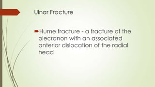 Ulnar Fracture
Hume fracture - a fracture of the
olecranon with an associated
anterior dislocation of the radial
head
 