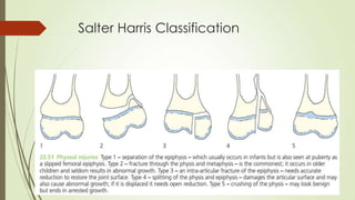 Salter Harris Classification
 