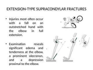 elbow and forearm presentation - DR. KEYUR.pptx
