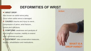 ELBOW AND WRIST their mechanics and muscle .pptx