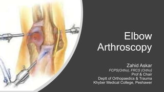 Elbow
Arthroscopy
Zahid Askar
FCPS(Ortho), FRCS (Ortho)
Prof & Chair
Deptt of Orthopaedics & Trauma
Khyber Medical College, Peshawer
 