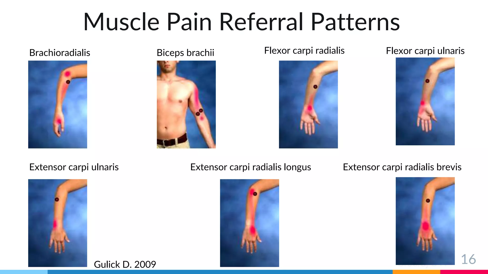 Sreeraj S R
Muscle Pain Referral Patterns
16
Brachioradialis Biceps brachii Flexor carpi radialis Flexor carpi ulnaris
Extensor carpi ulnaris Extensor carpi radialis longus Extensor carpi radialis brevis
Gulick D. 2009
 