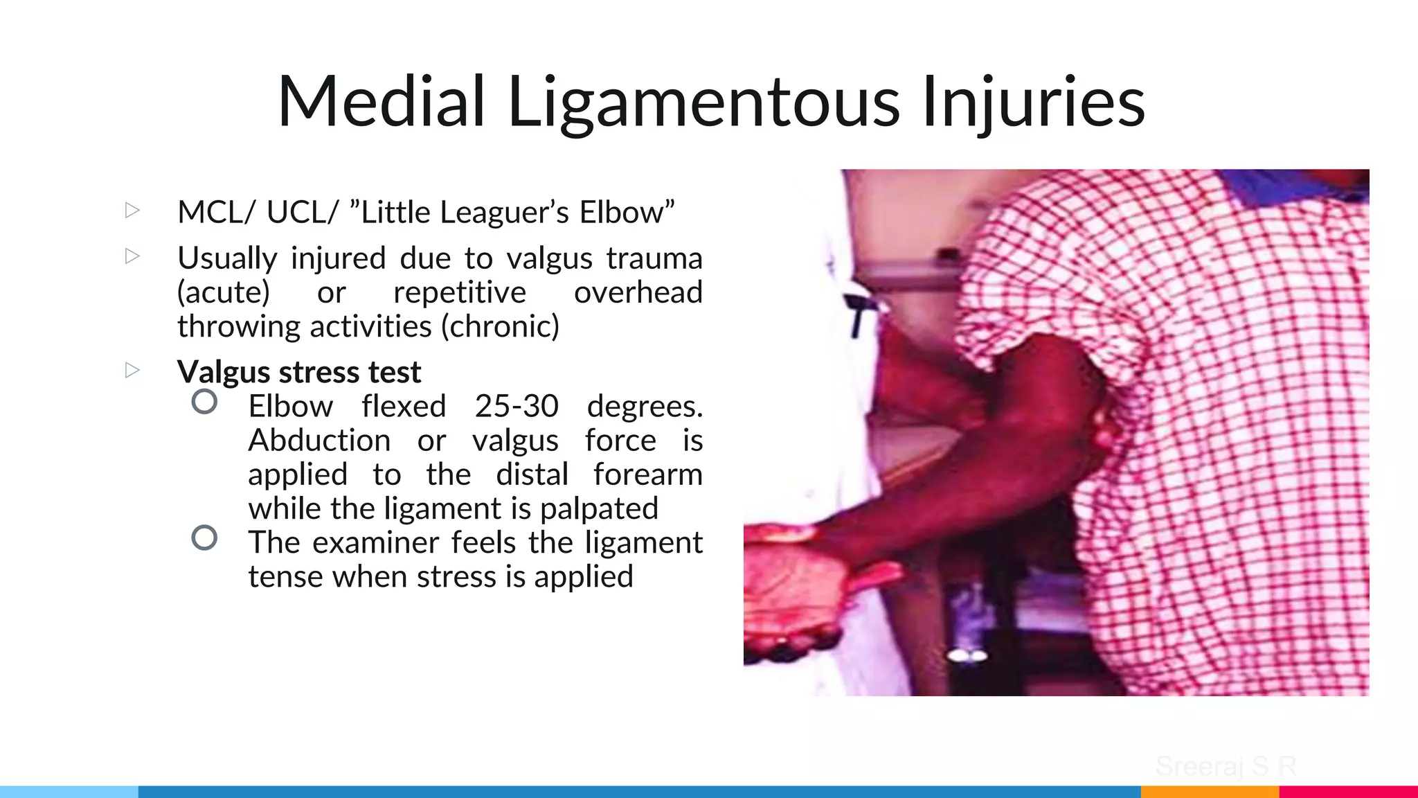 Sreeraj S R
Medial Ligamentous Injuries
▷ MCL/ UCL/ ”Little Leaguer’s Elbow”
▷ Usually injured due to valgus trauma
(acute) or repetitive overhead
throwing activities (chronic)
▷ Valgus stress test
○ Elbow flexed 25-30 degrees.
Abduction or valgus force is
applied to the distal forearm
while the ligament is palpated
○ The examiner feels the ligament
tense when stress is applied
 