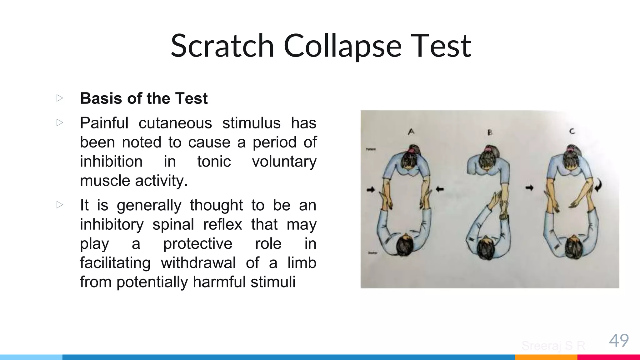 Sreeraj S R
Scratch Collapse Test
▷ Basis of the Test
▷ Painful cutaneous stimulus has
been noted to cause a period of
inhibition in tonic voluntary
muscle activity.
▷ It is generally thought to be an
inhibitory spinal reflex that may
play a protective role in
facilitating withdrawal of a limb
from potentially harmful stimuli
49
 