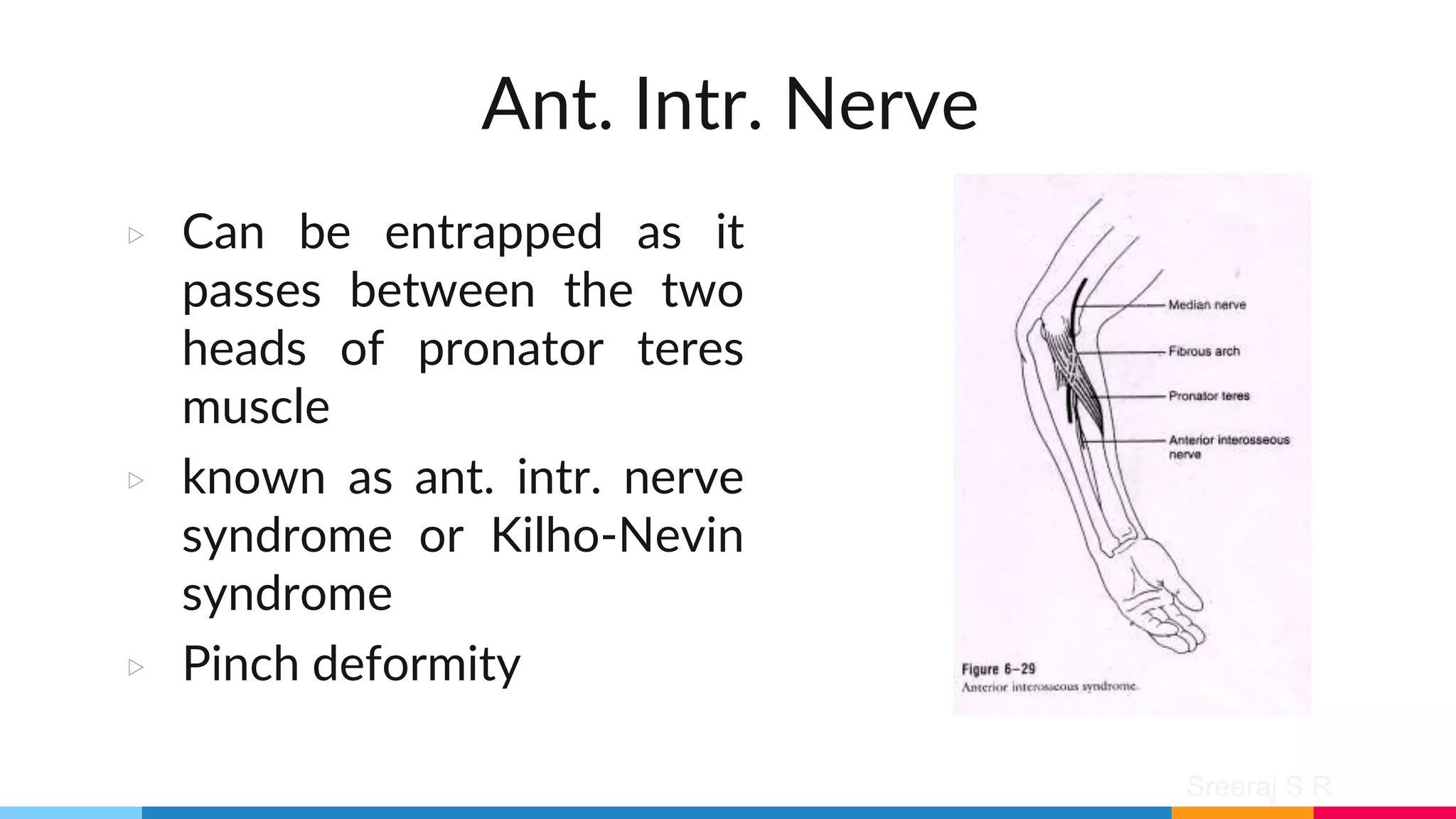Sreeraj S R
Ant. Intr. Nerve
▷ Can be entrapped as it
passes between the two
heads of pronator teres
muscle
▷ known as ant. intr. nerve
syndrome or Kilho-Nevin
syndrome
▷ Pinch deformity
 