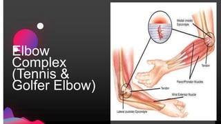Elbow
Complex
(Tennis &
Golfer Elbow)
 