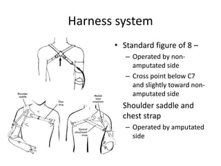 Harness system
• Standard figure of 8 –
– Operated by non-
amputated side
– Cross point below C7
and slightly toward non-
amputated side
• Shoulder saddle and
chest strap
– Operated by amputated
side
 