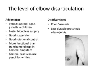 The level of elbow disarticulation
Advantages
• Permits normal bone
growth in children
• Faster bloodless surgery
• Good suspension
• Good rotational control
• More functional than
transhumeral esp. in
bilateral amputees
• Bilateral cases can use
pencil for writing
Disadvantages
• Poor Cosmesis
• Less durable prosthetic
elbow joints
 