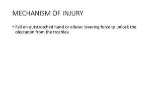 MECHANISM OF INJURY
• Fall on outstretched hand or elbow: levering force to unlock the
olecranon from the trochlea
 