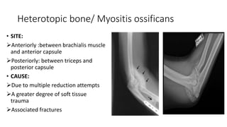 Heterotopic bone/ Myositis ossificans
• SITE:
Anteriorly :between brachialis muscle
and anterior capsule
Posteriorly: between triceps and
posterior capsule
• CAUSE:
Due to multiple reduction attempts
A greater degree of soft tissue
trauma
Associated fractures
 
