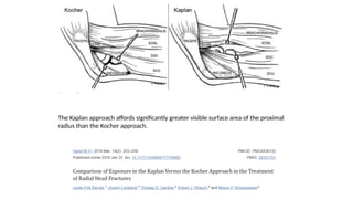 Elbow dislocation with radial head fracture | PPTX