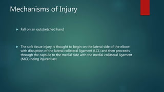 Mechanisms of Injury
 Fall on an outstretched hand
 The soft tissue injury is thought to begin on the lateral side of the elbow
with disruption of the lateral collateral ligament (LCL) and then proceeds
through the capsule to the medial side with the medial collateral ligament
(MCL) being injured last
 