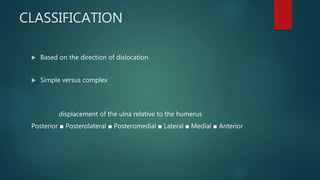 CLASSIFICATION
 Based on the direction of dislocation
 Simple versus complex
displacement of the ulna relative to the humerus
Posterior ■ Posterolateral ■ Posteromedial ■ Lateral ■ Medial ■ Anterior
 
