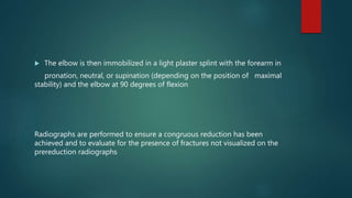  The elbow is then immobilized in a light plaster splint with the forearm in
pronation, neutral, or supination (depending on the position of maximal
stability) and the elbow at 90 degrees of flexion
Radiographs are performed to ensure a congruous reduction has been
achieved and to evaluate for the presence of fractures not visualized on the
prereduction radiographs
 