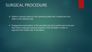 SURGICAL PROCEDURE
 Patient is placed supine on the operating table with a radiolucent arm
table on the affected side
 Preoperative examination of the shoulder should be performed to be sure
that there is adequate external rotation of the shoulder in order to
approach the medial side of the elbow
 