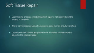 Soft Tissue Repair
 Vast majority of cases, a medial ligament repair is not required and the
surgery is complete
 The lcl can be repaired using transosseous bone tunnels or suture anchors
 Locking krackow stitches are placed in the lcl while a second suture is
placed in the extensor fascia
 