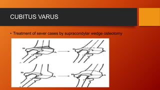 Elbow disorders 5th stage lecture (dr.farouk)