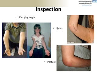 Inspection
• Carrying angle
• Posture
• Scars
 