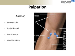 Palpation
Anterior
• Coronoid tip
• Radial Tunnel
• Distal Biceps
• Brachial artery
 