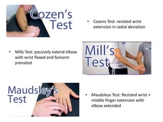 • Maudsleys Test: Resisted wrist +
middle finger extension with
elbow extended
• Cozens Test: resisted wrist
extension in radial deviation
• Mills Test: passively extend elbow
with wrist flexed and forearm
pronated
 
