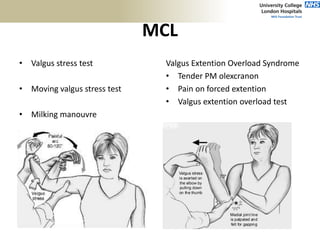 MCL
• Valgus stress test
• Moving valgus stress test
• Milking manouvre
Valgus Extention Overload Syndrome
• Tender PM olexcranon
• Pain on forced extention
• Valgus extention overload test
 