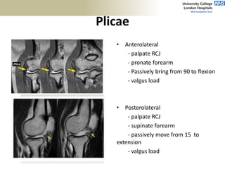 Plicae
• Anterolateral
- palpate RCJ
- pronate forearm
- Passively bring from 90 to flexion
- valgus load
• Posterolateral
- palpate RCJ
- supinate forearm
- passively move from 15 to
extension
- valgus load
 