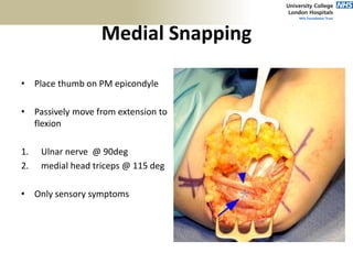 Medial Snapping
• Place thumb on PM epicondyle
• Passively move from extension to
flexion
1. Ulnar nerve @ 90deg
2. medial head triceps @ 115 deg
• Only sensory symptoms
 