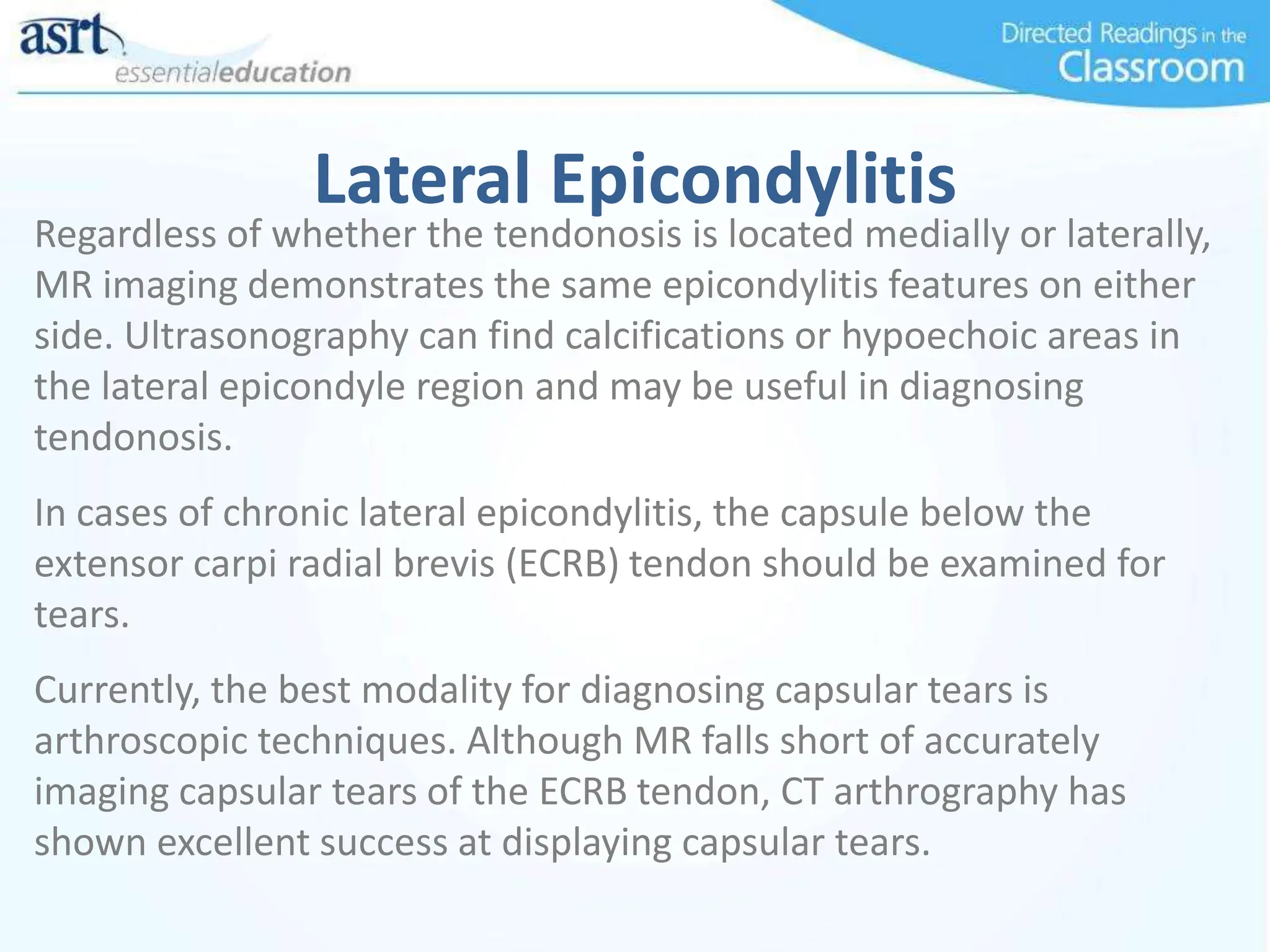 Lateral Epicondylitis
Regardless of whether the tendonosis is located medially or laterally,
MR imaging demonstrates the same epicondylitis features on either
side. Ultrasonography can find calcifications or hypoechoic areas in
the lateral epicondyle region and may be useful in diagnosing
tendonosis.
In cases of chronic lateral epicondylitis, the capsule below the
extensor carpi radial brevis (ECRB) tendon should be examined for
tears.
Currently, the best modality for diagnosing capsular tears is
arthroscopic techniques. Although MR falls short of accurately
imaging capsular tears of the ECRB tendon, CT arthrography has
shown excellent success at displaying capsular tears.
 