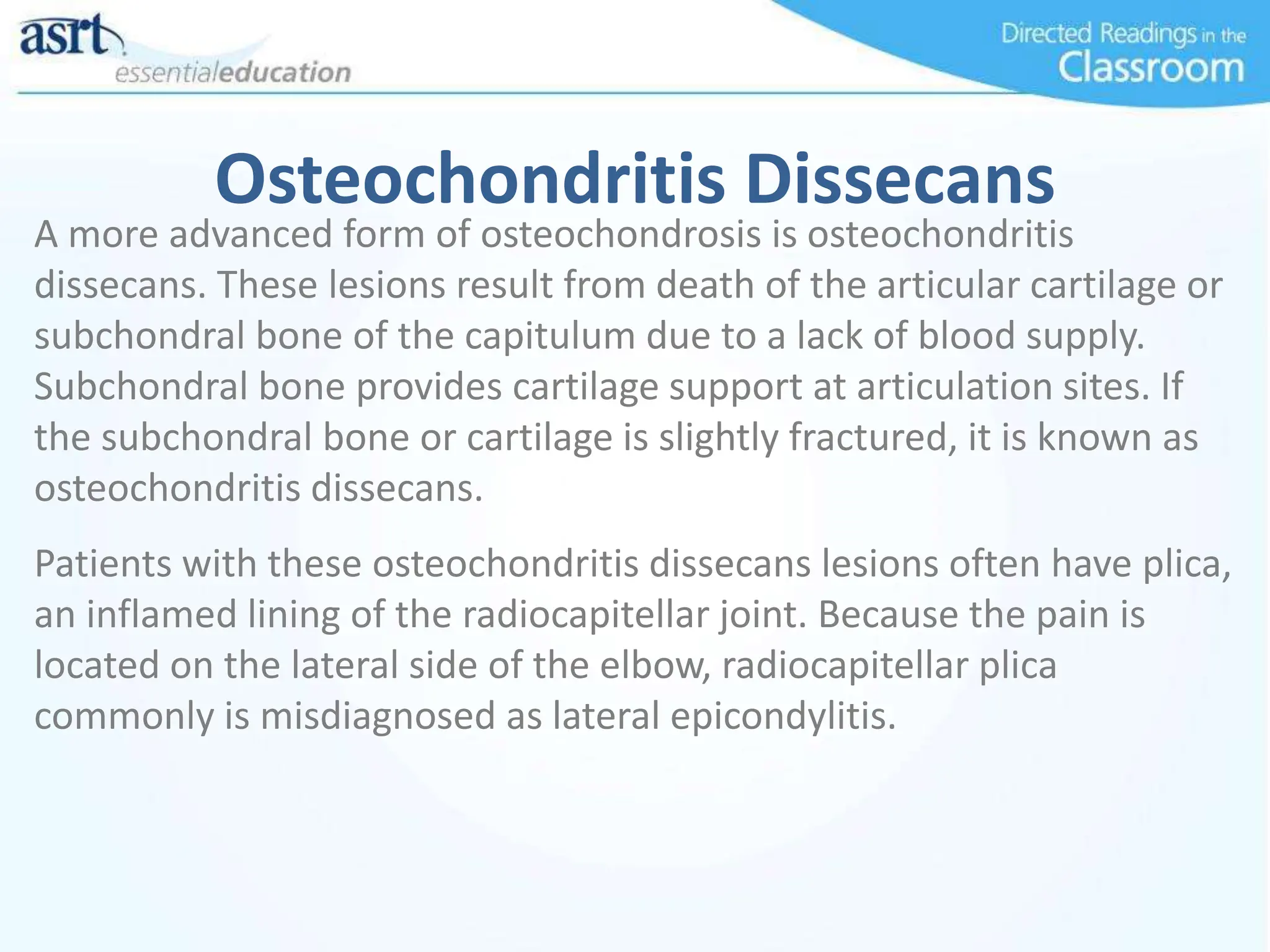 Osteochondritis Dissecans
A more advanced form of osteochondrosis is osteochondritis
dissecans. These lesions result from death of the articular cartilage or
subchondral bone of the capitulum due to a lack of blood supply.
Subchondral bone provides cartilage support at articulation sites. If
the subchondral bone or cartilage is slightly fractured, it is known as
osteochondritis dissecans.
Patients with these osteochondritis dissecans lesions often have plica,
an inflamed lining of the radiocapitellar joint. Because the pain is
located on the lateral side of the elbow, radiocapitellar plica
commonly is misdiagnosed as lateral epicondylitis.
 