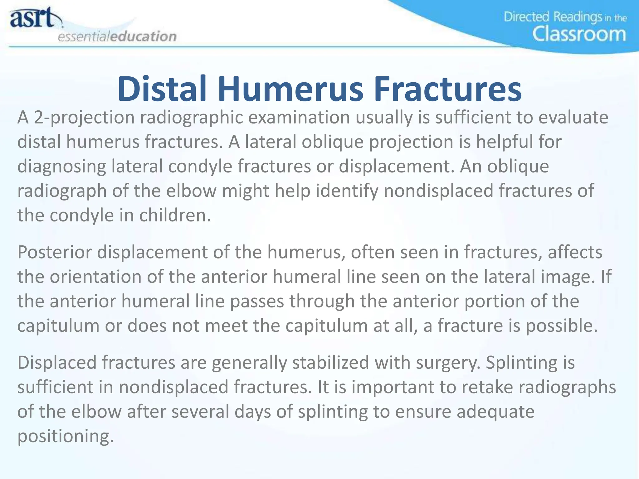 Distal Humerus Fractures
A 2-projection radiographic examination usually is sufficient to evaluate
distal humerus fractures. A lateral oblique projection is helpful for
diagnosing lateral condyle fractures or displacement. An oblique
radiograph of the elbow might help identify nondisplaced fractures of
the condyle in children.
Posterior displacement of the humerus, often seen in fractures, affects
the orientation of the anterior humeral line seen on the lateral image. If
the anterior humeral line passes through the anterior portion of the
capitulum or does not meet the capitulum at all, a fracture is possible.
Displaced fractures are generally stabilized with surgery. Splinting is
sufficient in nondisplaced fractures. It is important to retake radiographs
of the elbow after several days of splinting to ensure adequate
positioning.
 