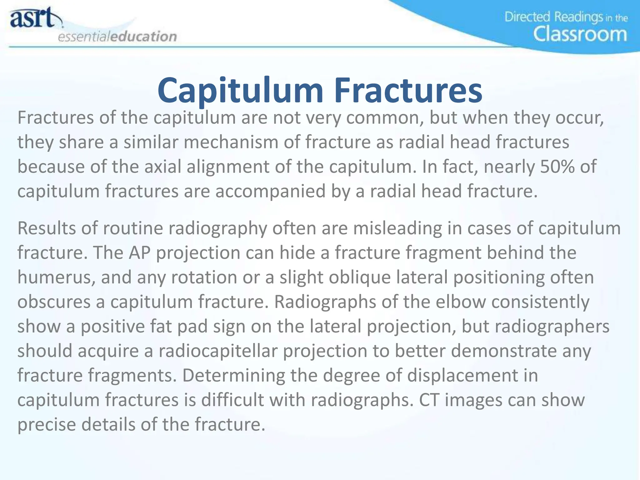 Capitulum Fractures
Fractures of the capitulum are not very common, but when they occur,
they share a similar mechanism of fracture as radial head fractures
because of the axial alignment of the capitulum. In fact, nearly 50% of
capitulum fractures are accompanied by a radial head fracture.
Results of routine radiography often are misleading in cases of capitulum
fracture. The AP projection can hide a fracture fragment behind the
humerus, and any rotation or a slight oblique lateral positioning often
obscures a capitulum fracture. Radiographs of the elbow consistently
show a positive fat pad sign on the lateral projection, but radiographers
should acquire a radiocapitellar projection to better demonstrate any
fracture fragments. Determining the degree of displacement in
capitulum fractures is difficult with radiographs. CT images can show
precise details of the fracture.
 