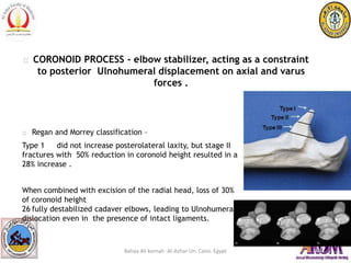 Coronoid Classification Elbow instability | PPT