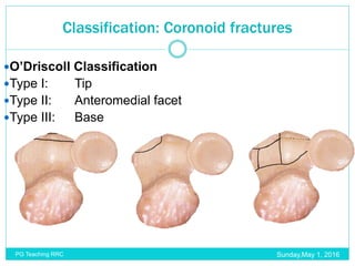 Coronoid Classification Elbow trauma & infection | PPTX