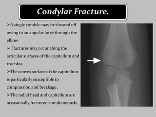 Raidal Condyle Elbow joint | PPTX