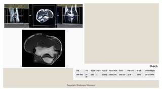 Seyedeh Shabnam Mousavi
 