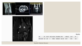 Seyedeh Shabnam Mousavi
 
