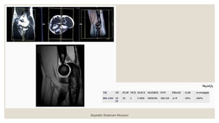 Seyedeh Shabnam Mousavi
 
