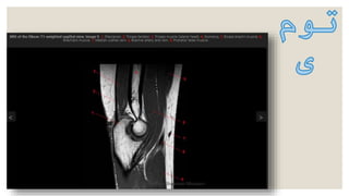 Seyedeh Shabnam Mousavi
 