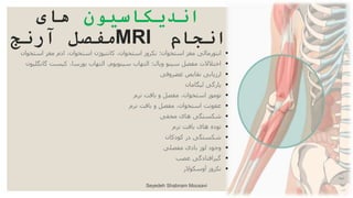 ‫اندیکاسیون‬
‫های‬
‫انجام‬
MRI
‫آرنج‬ ‫مفصل‬

‫استخوان‬ ‫مغز‬ ‫ابنورمالی‬
:
‫استخو‬ ‫مغز‬ ‫ادم‬ ،‫استخوان‬ ‫کانتیوژن‬ ،‫استخوان‬ ‫نکروز‬
‫ان‬

‫ویال‬ ‫سینو‬ ‫مفصل‬ ‫اختالالت‬
:
‫گان‬ ‫کیست‬ ،‫بورسا‬ ‫التهاب‬ ،‫سینویوم‬ ‫التهاب‬
‫گلیون‬

‫غضروفی‬ ‫نقایص‬ ‫ارزیابی‬

‫لیگامان‬ ‫پارگی‬

‫نرم‬ ‫بافت‬ ‫و‬ ‫مفصل‬ ،‫استخوان‬ ‫تومور‬

‫نرم‬ ‫بافت‬ ‫و‬ ‫مفصل‬ ،‫استخوان‬ ‫عفونت‬

‫مخفی‬ ‫های‬ ‫شکستگی‬

‫نرم‬ ‫بافت‬ ‫های‬ ‫توده‬

‫کودکان‬ ‫در‬ ‫شکستگی‬

‫مفصلی‬ ‫بادی‬ ‫لوز‬ ‫وجود‬

‫عصب‬ ‫گیرافتادگی‬

‫آوسکوالر‬ ‫نکروز‬
Seyedeh Shabnam Mousavi
 