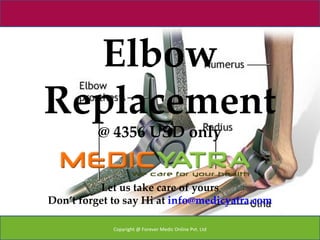 Elbow
Replacement
          @ 4356 USD only


          Let us take care of yours
Don’t forget to say Hi at info@medicyatra.com

             Copyright @ Forever Medic Online Pvt. Ltd
 