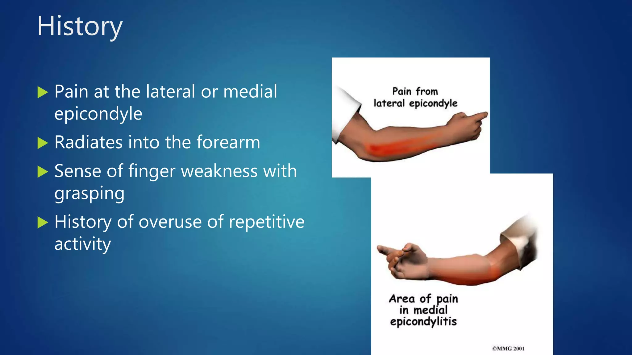Distal Biceps Tendon Ruptures | Elbow Tendinopathies | South Windsor ...