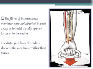 The fibres of interrosseous
membrane are not directed in such
a way as to resist distally applied
forces onto the radius
The distal pull from the radius
slackens the membrane rather than
tenses.
 