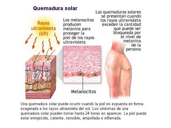 Â 